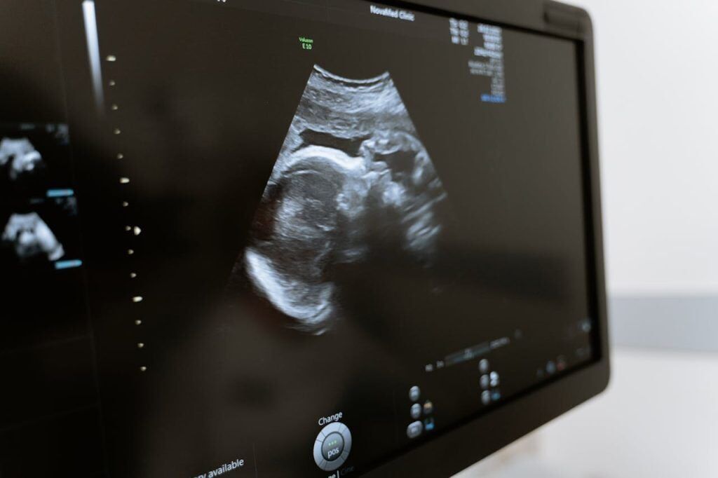 Planned C-sections put babies at high risk of cancer: study